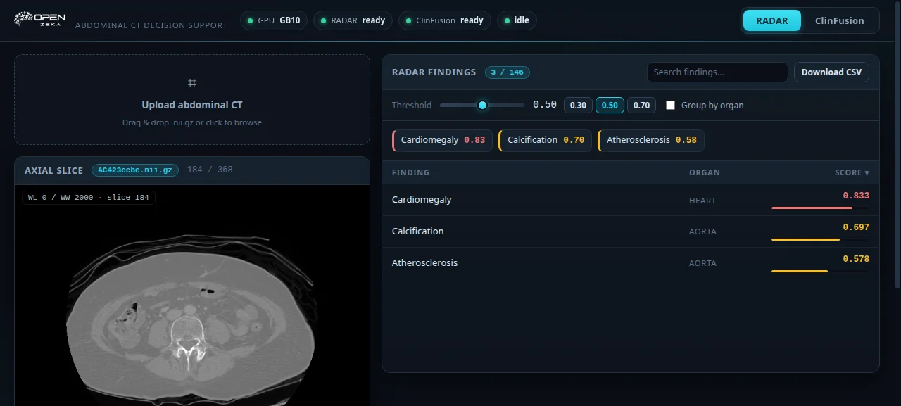 Completed RADAR analysis: CT slice viewer on the left and thresholded findings on the right